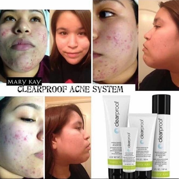 MARY KAY Clear Proof Acne System Set - Picture 2 of 6